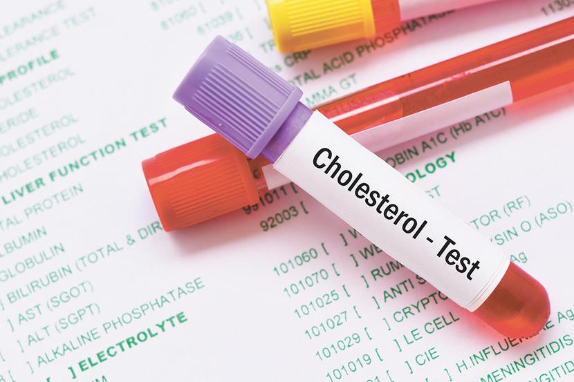 Jak wyjaśniają naukowcy, wyższe stężenie cholesterolu HDL może pomóc w zapobieganiu udarowi lub zawałowi serca, ale jednocześnie może zaburzyć równowagę określonego rodzaju białka, związanego z rozwojem alzheimera. Jak wyjaśniają naukowcy, wyższe stężenie cholesterolu HDL może pomóc w zapobieganiu udarowi lub zawałowi serca, ale jednocześnie może zaburzyć równowagę określonego rodzaju białka, związanego z rozwojem alzheimera.