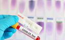 Naukowcy z UJ bliscy opracowania ultraszybkiego testu na koronawirusa