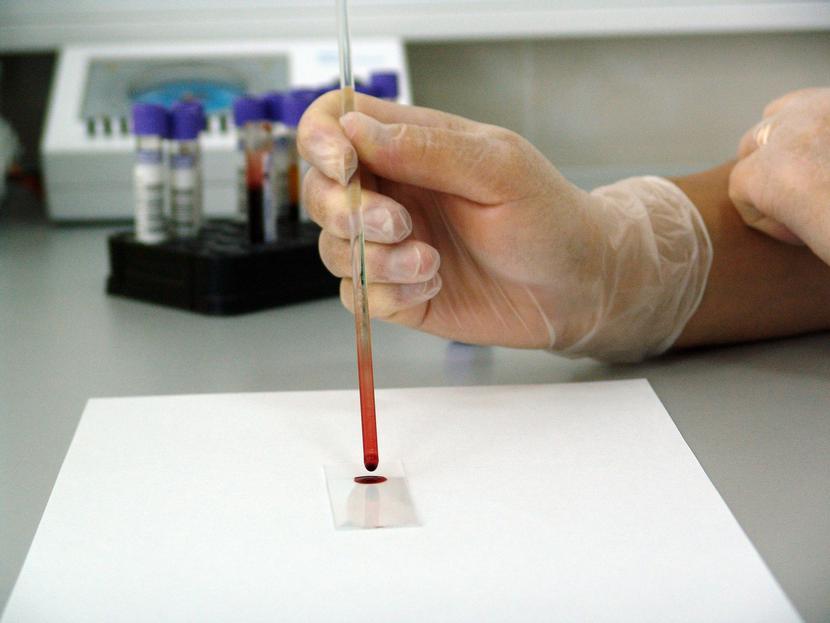 MZ: średni koszt 4-letniego szkolenia specjalizacyjnego w każdej z 13 dziedzin diagnostyki laboratoryjnej wynosi ok. 18 000 zł.
