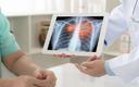 Badanie tomograficzne płuc (CTA) pacjentów po udarze może wcześnie wykryć COVID-19 [BADANIA]