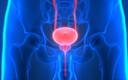 Rak prostaty: polscy naukowcy ocenią terapię redukującą ryzyko nawrotu