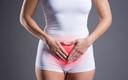 Endometrioza: ruszają prace nad szybkim, nieinwazyjnym testem