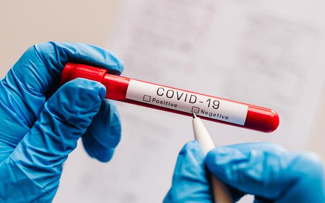 Long COVID - badacze wykryli we krwi markery zaburzeń po zakażeniu SARS-CoV-2