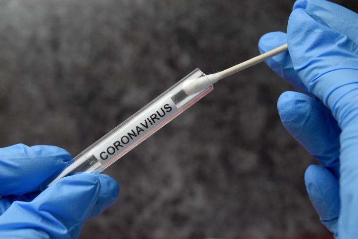 Kto poza lekarzami podstawowej opieki zdrowotnej będzie mógł zlecić test w kierunku SARS-CoV-2? Kto poza lekarzami podstawowej opieki zdrowotnej będzie mógł zlecić test w kierunku SARS-CoV-2?