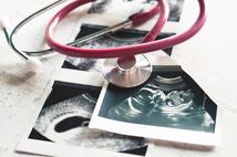Sejm zajmie się projektem zaostrzającym prawo do aborcji