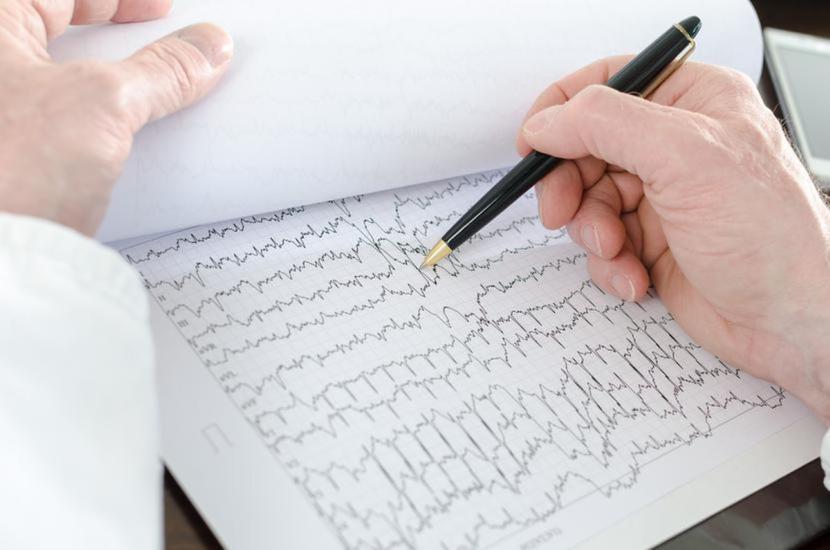 Rozszerzenie pilotażu Krajowej Sieci Kardiologicznej skutkować ma łatwiejszym i szybszym dostępem do specjalisty. Rozszerzenie pilotażu Krajowej Sieci Kardiologicznej skutkować ma łatwiejszym i szybszym dostępem do specjalisty.