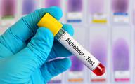 Test z krwi wykrywający alzheimera: dwie firmy rekrutują ochotników do badania klinicznego