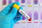 Test z krwi wykrywający alzheimera: dwie firmy rekrutują ochotników do badania klinicznego