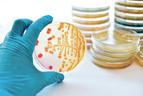 Problem wieloopornych bakterii w placówkach medycznych