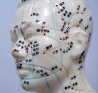 Potwierdzono przeciwbólowe działanie akupunktury
