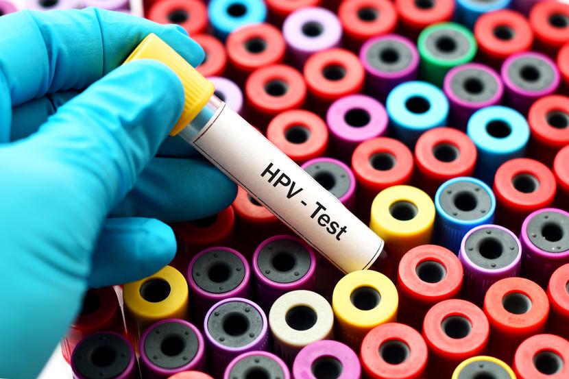 Blood sample for HPV test Blood sample for HPV test