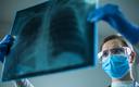 MZ chce poprawić jakość leczenia radiologicznego