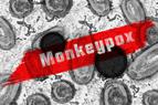 Małpia ospa: jest pierwszy skuteczny lek? [BADANIE]
