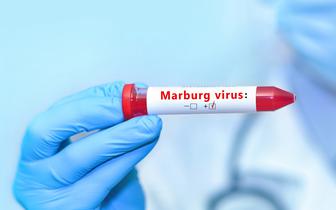 WHO ogłasza kolejne przypadki zakażeń wirusem Marburg