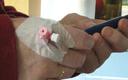 Opieka diabetologiczna: quo vadis?