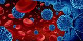 Remisja hematologiczna CLL po zastosowaniu wenetoklaksu z obinutuzumabem [PRZYPADEK KLINICZNY]