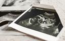 Prof. Czajkowski: lekarz powinien zakończyć ciążę, gdy stanowi ona zagrożenie dla matki