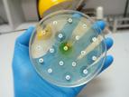 Ekspert o odkryciu, które może pomóc w walce z antybiotykoopornością