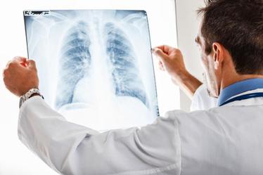 Instytut Gruźlicy i Chorób Płuc dołącza do Polskiej Sieci Badań Klinicznych
