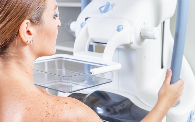 Amerykańscy eksperci zalecają mammografię już od 40. roku życia