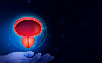 Rak prostaty – rezonans magnetyczny połączony z badaniem PSA standardowym modelem skriningowym?