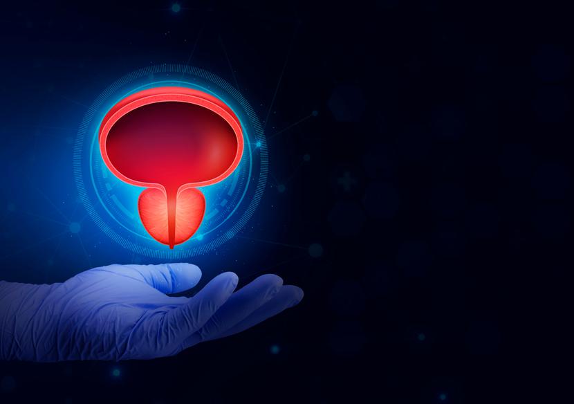 Celem skriningu raka gruczołu krokowego jest ograniczenie niepotrzebnego wykrywania nowotworów niemających znaczenia klinicznego i poprawa wykrywalności nowotworów agresywnych. Celem skriningu raka gruczołu krokowego jest ograniczenie niepotrzebnego wykrywania nowotworów niemających znaczenia klinicznego i poprawa wykrywalności nowotworów agresywnych.