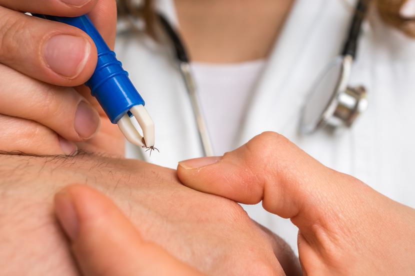 Yylko ok. 5 proc. ukąszeń kleszczy kończy się zakażeniem boreliozą, nawet jeśli kleszcz jest zakażony.