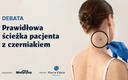 Prawidłowa ścieżka diagnostyczno-terapeutyczna pacjenta z czerniakiem [DEBATA]
