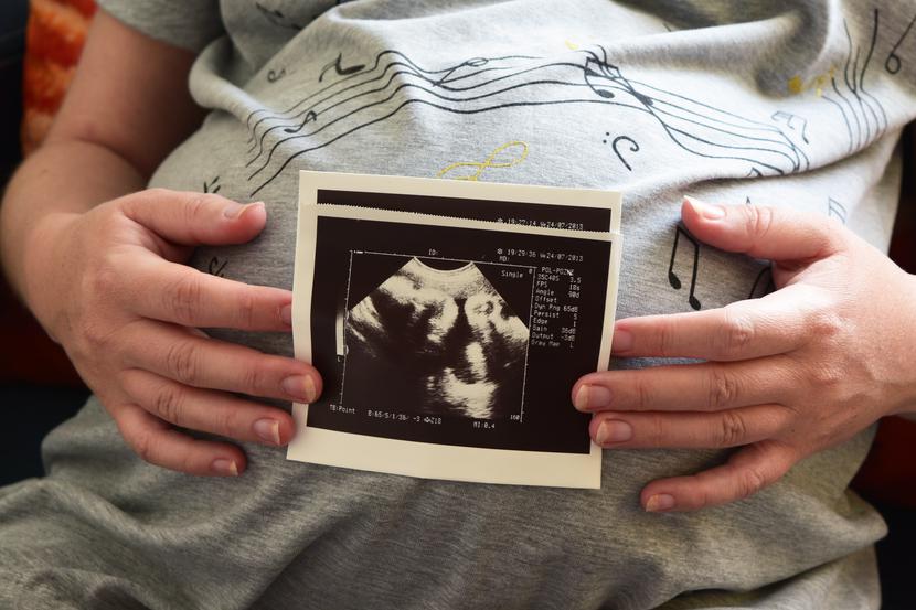 Rządowy program in vitro obejmuje sześć indywidualnych procedur wspomaganego rozrodu. Rządowy program in vitro obejmuje sześć indywidualnych procedur wspomaganego rozrodu.