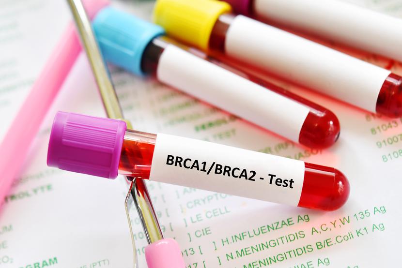 Mężczyzn nie można pomijać w diagnostyce genetycznej w kierunku mutacji w genach BRCA. Mężczyzn nie można pomijać w diagnostyce genetycznej w kierunku mutacji w genach BRCA.
