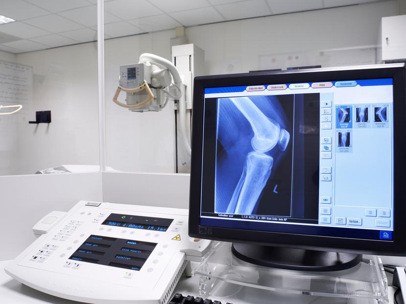 Jedna z dotacji, które otrzymał szpital, obejmowała doposażenie w cyfrowy system diagnostyki obrazowej do jednoczasowego wykonywania dwupłaszczyznowych, sylwetkowych zdjęć rtg w pozycji stojącej.