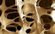 Światowy Dzień Chorych na Osteoporozę
