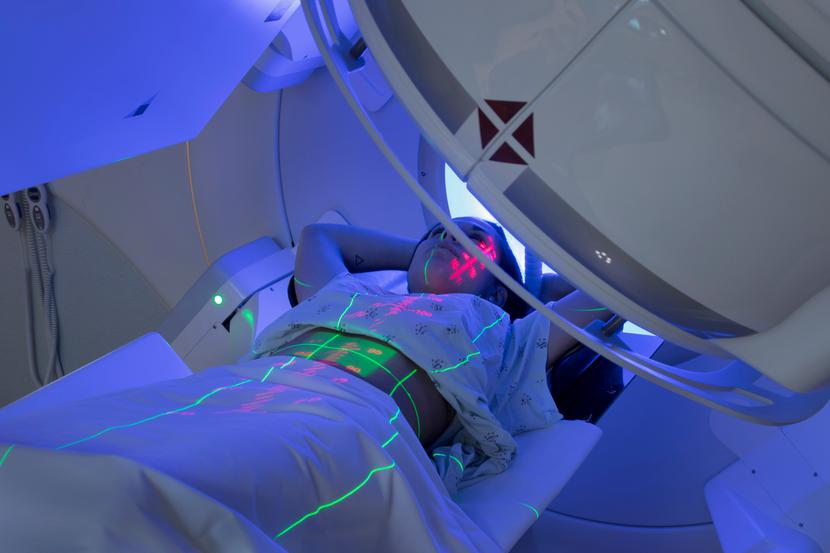 Opracowanie optymalnego planu radioterapii wymaga wielu przygotowań. Celem jest wyleczenie dziecka przy jak najmniejszej toksyczności dla zdrowych tkanek i minimalizacji skutków ubocznych. Opracowanie optymalnego planu radioterapii wymaga wielu przygotowań. Celem jest wyleczenie dziecka przy jak najmniejszej toksyczności dla zdrowych tkanek i minimalizacji skutków ubocznych.