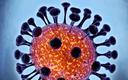 BioMaxima chce zarejestrować szybkie testy na koronowirusa