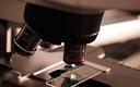 Nowy biomarker użyteczny w kontroli ALS