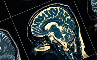 Choroba Parkinsona zaczyna się w jelitach? W weryfikacji tej teorii ma pomóc nicień