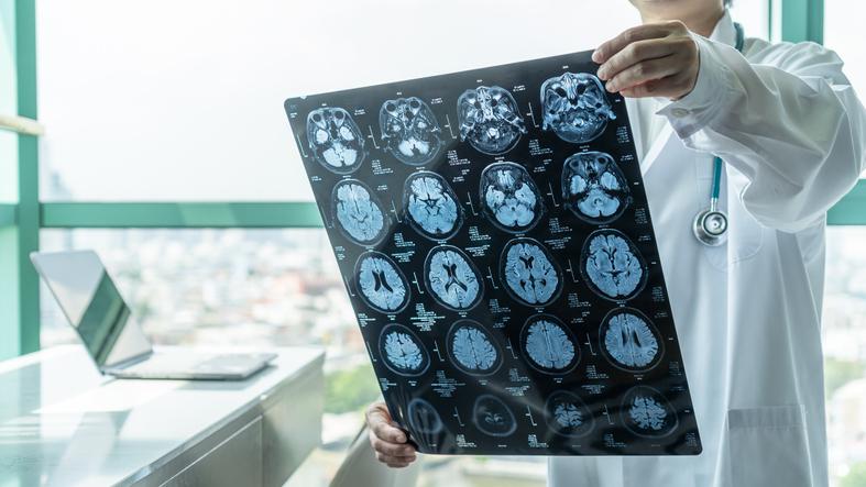 W Centrum Badań Mózgu będzie wykorzystywany najnowszy skaner przeznaczony do badań naukowych ośrodkowego układu nerwowego. W Centrum Badań Mózgu będzie wykorzystywany najnowszy skaner przeznaczony do badań naukowych ośrodkowego układu nerwowego.