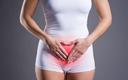 Australijscy naukowcy dokonali przełomu w leczeniu endometriozy