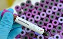 NFZ zapłaci za wykonywanie testów na obecność koronawirusa SARS-CoV-2